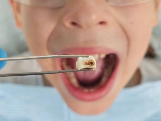 Best Emergency Dental Extractions in Liberty Corner, NJ