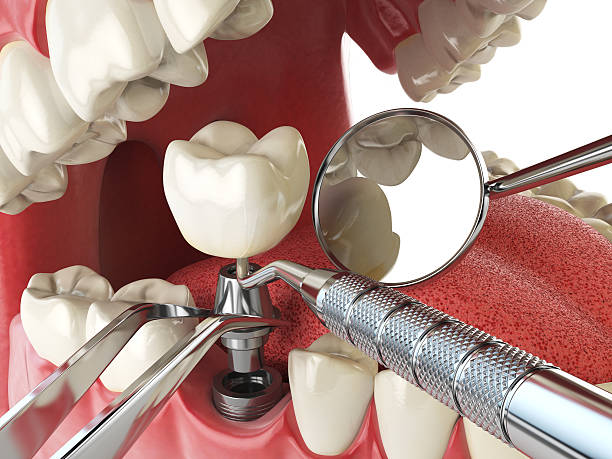 Best Orthodontic Emergency Dentist in Liberty Corner, NJ